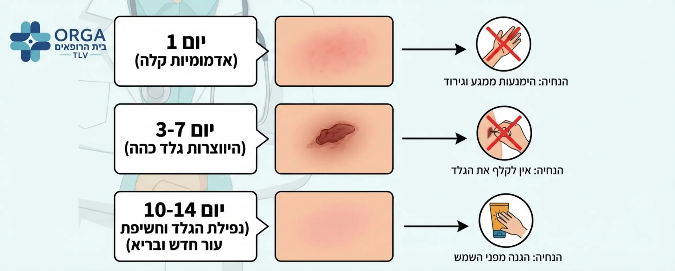 תרשים זרימה המתאר את תהליך ההחלמה: יום 1 (אדמומיות קלה), יום 3-7 (היווצרות גלד כהה), יום 10-14 (נפילת הגלד וחשיפת עור חדש ובריא). ליד כל שלב יש אייקון המייצג את ההנחיה החשובה ביותר, למשל אייקון של
