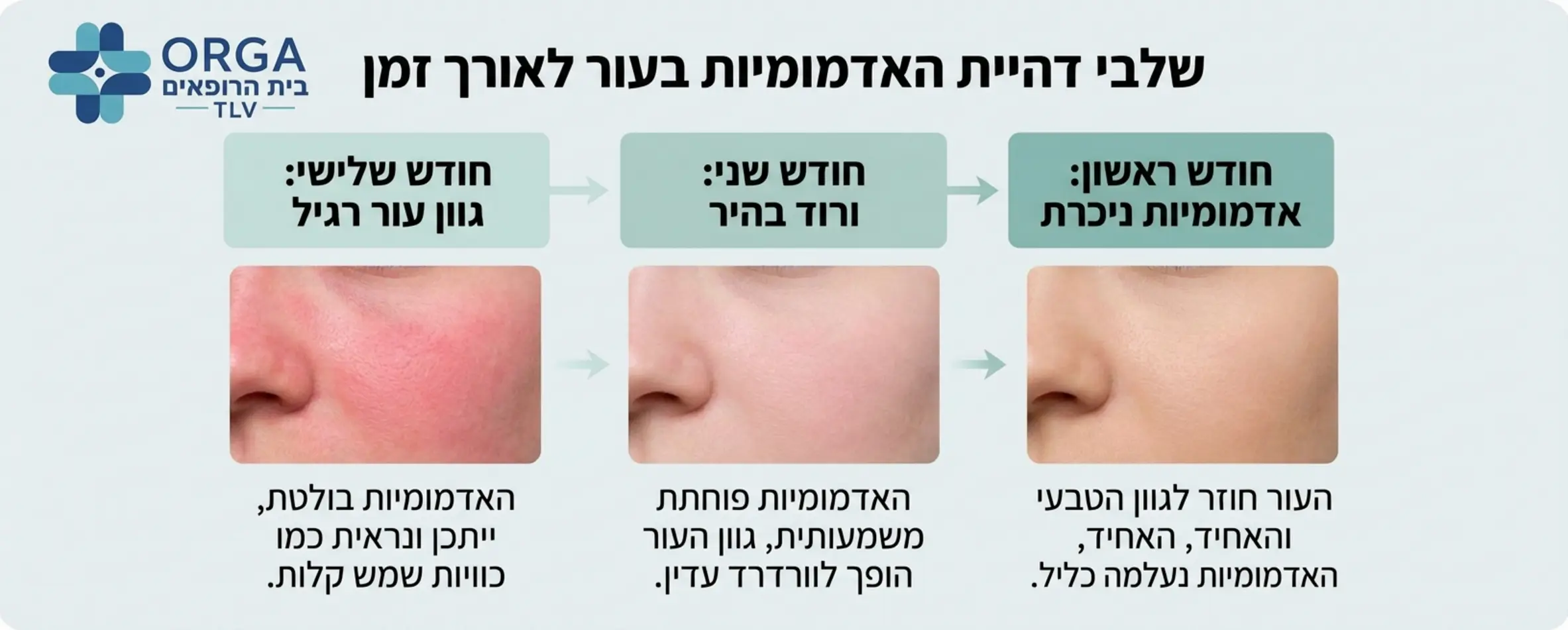 אינפוגרפיקה המציגה את שלבי דהיית האדמומיות לאורך זמן: תמונה של עור ורוד בחודש הראשון, ורוד בהיר בחודש השני, ועור בגוון רגיל בחודש השלישי