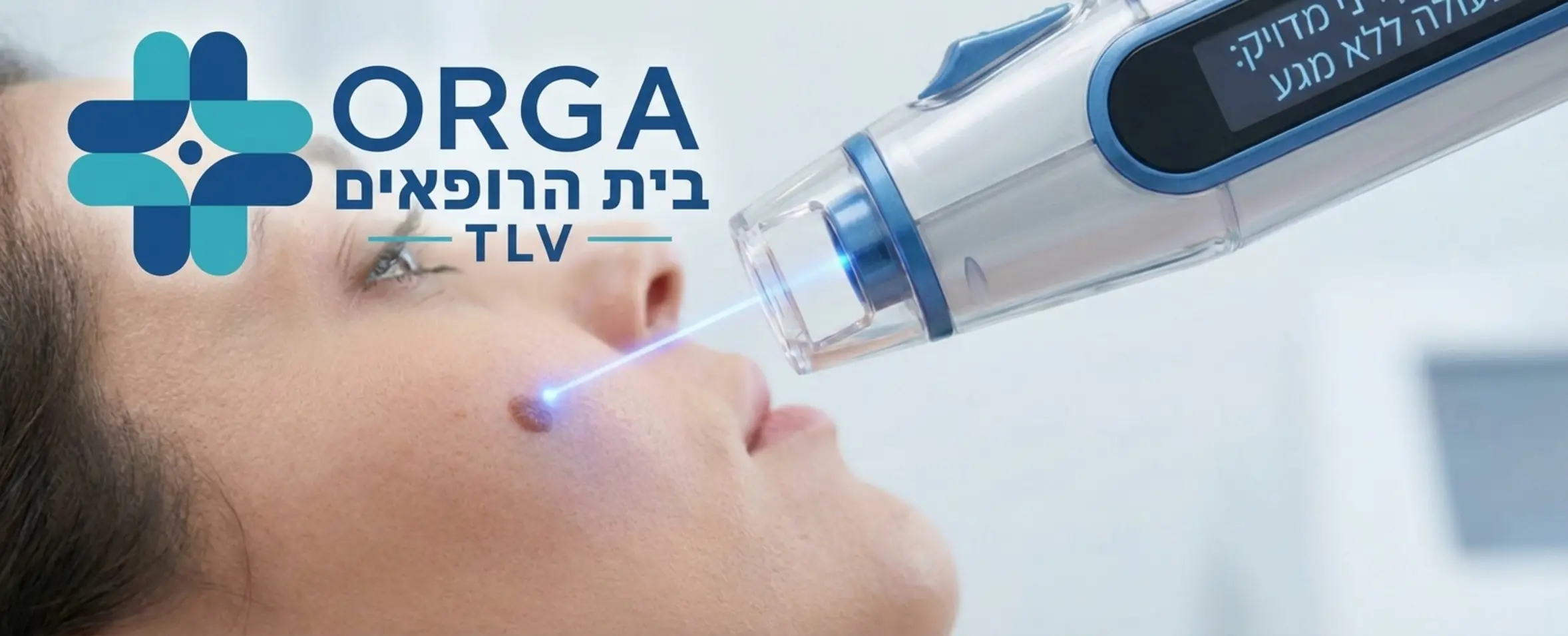 צילום תקריב איכותי של מכשיר לייזר קליני מתקדם המקרין אלומת אור מדויקת אל עבר נקודת חן שטוחה על לחי של מטופלת, הממחיש את הדיוק, הניקיון של הפעולה והיעדר המגע הישיר של מכשור מתכתי בעור