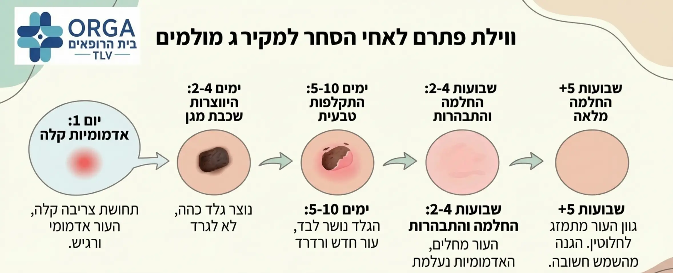 תרשים זרימה גרפי ונעים לעין המפרט את שלבי ההחלמה לאחר הסרת נקודת חן בלייזר, החל מהיום הראשון בו מופיעה אדמומיות קלה, דרך יצירת שכבת מגן טבעית ועד להחלמה המלאה והתמזגות גוון העור לאחר מספר שבועות