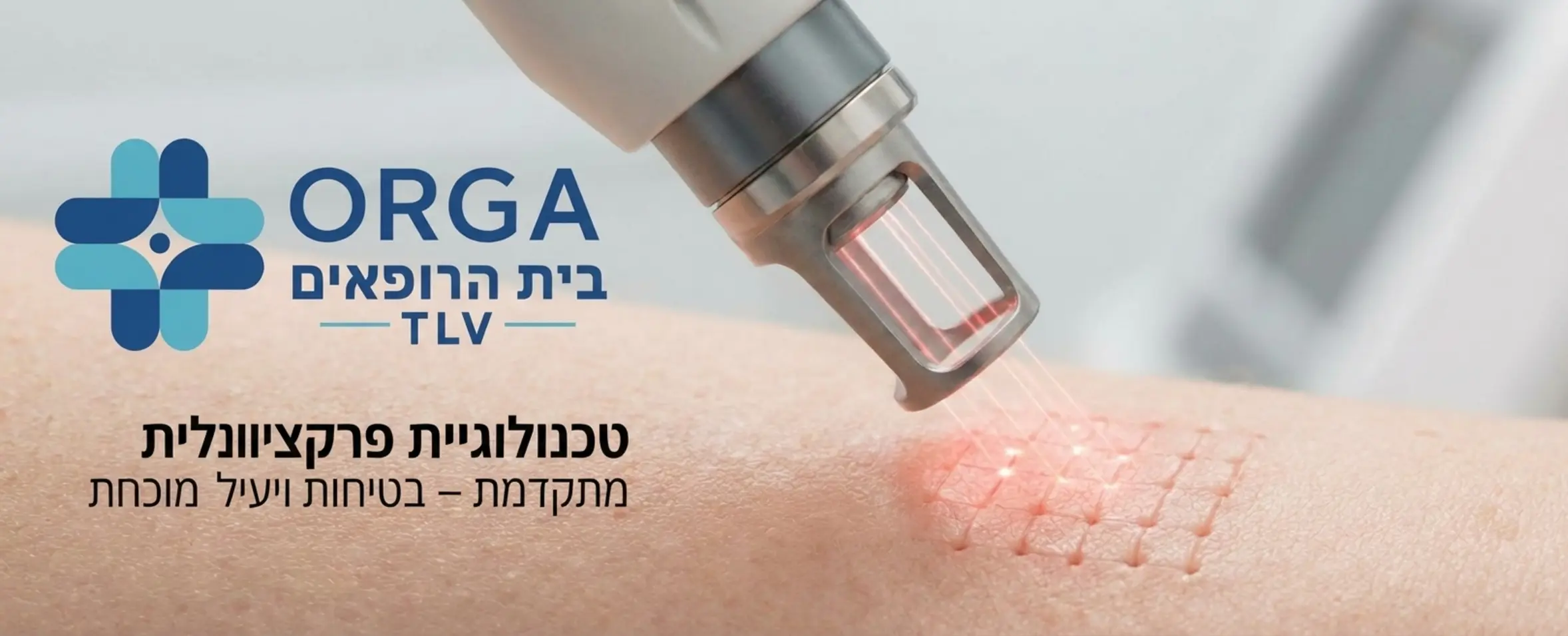 צילום תקריב איכותי של מכשיר לייזר פרקציונלי מתקדם בפעולה על רקמת עור בהירה תוך הדגשת קרני הלייזר העדינות החודרות לעור בצורה מבוקרת ומדויקת