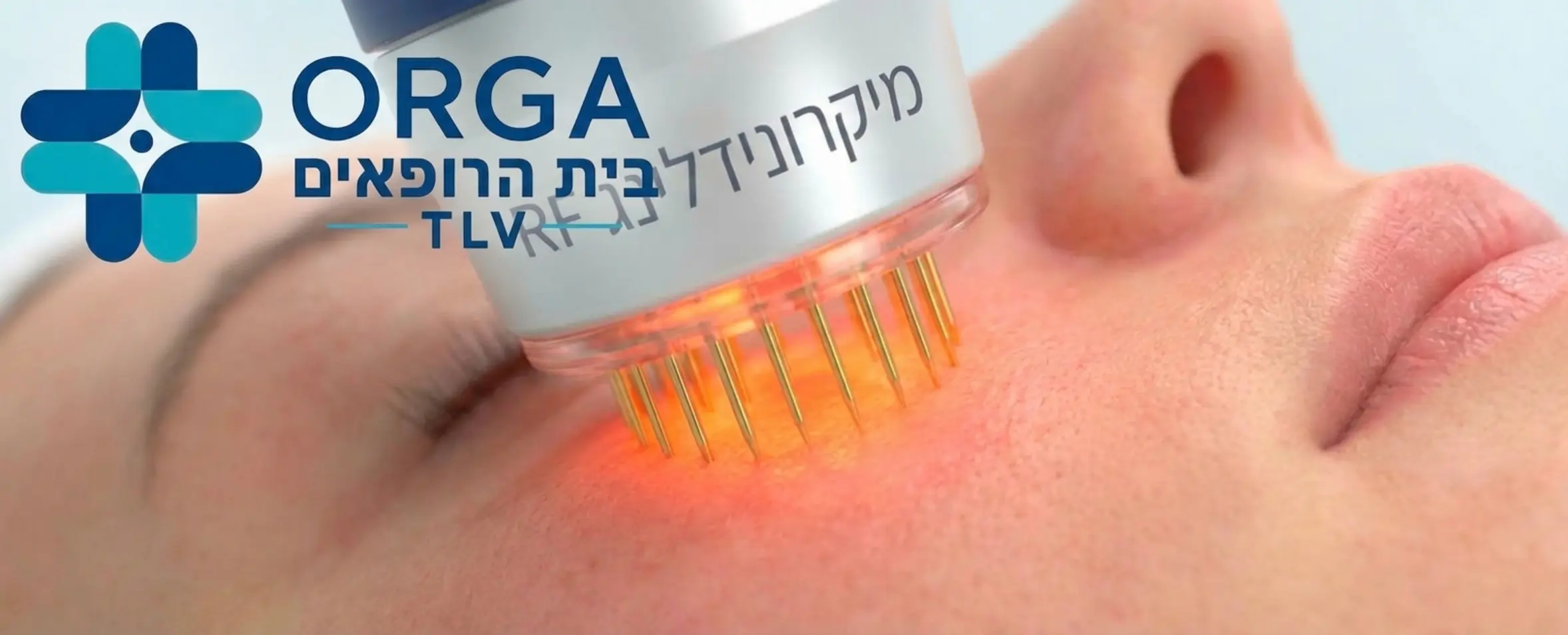 צילום תקריב איכותי של מכשיר מיקרונידלינג RF בזמן פעולה על עור הפנים, הממחיש את חדירת המחטים הזעירות אל מתחת לפני השטח כדי להעביר אנרגיית חום לשכבת הדרמיס