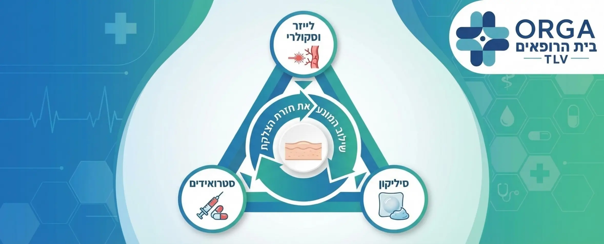 אינפוגרפיקה מעוצבת בצורת משולש המדגימה את הטיפול המשולש: קודקוד אחד מייצג לייזר וסקולרי, קודקוד שני מייצג סטרואידים, וקודקוד שלישי מייצג סיליקון, עם חצים המראים כיצד השילוב מונע את חזרת הצלקת