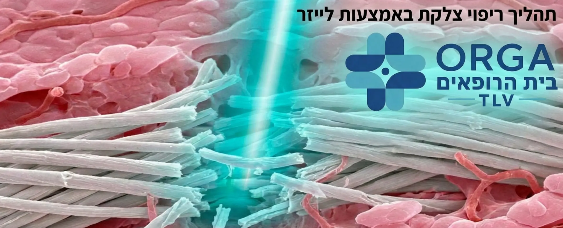 תמונת מאקרו מפורטת הממחישה כיצד קרן הלייזר מפרקת את סיבי הקולגן הנוקשים של הצלקת ומעודדת צמיחה של עור חדש ובריא מסביב לאזור המטופל