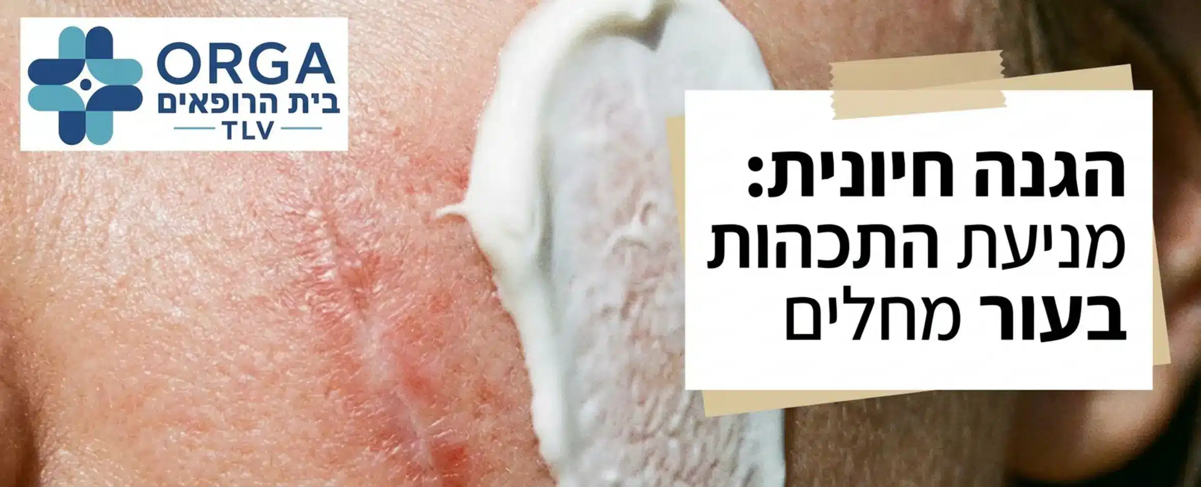 צילום תקריב איכותי של מריחת קרם הגנה בעל מקדם גבוה על אזור של עור מחלים, עם כיתוב גרפי המדגיש את חשיבות ההגנה מקרינת השמש למניעת התכהות