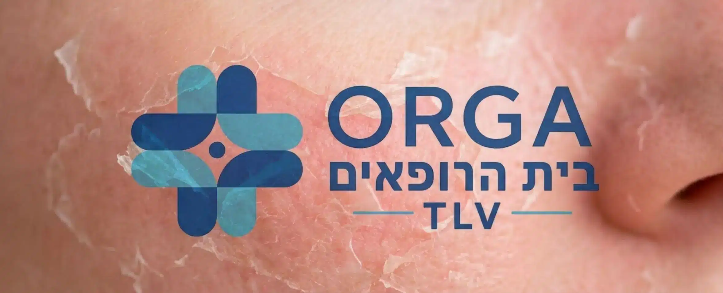 תמונת קלוז אפ של עור פנים במצב של החלמה מתקדמת לאחר טיפול לייזר, מראה את הקילוף העדין ואת העור החדש והוורוד שנחשף מתחת