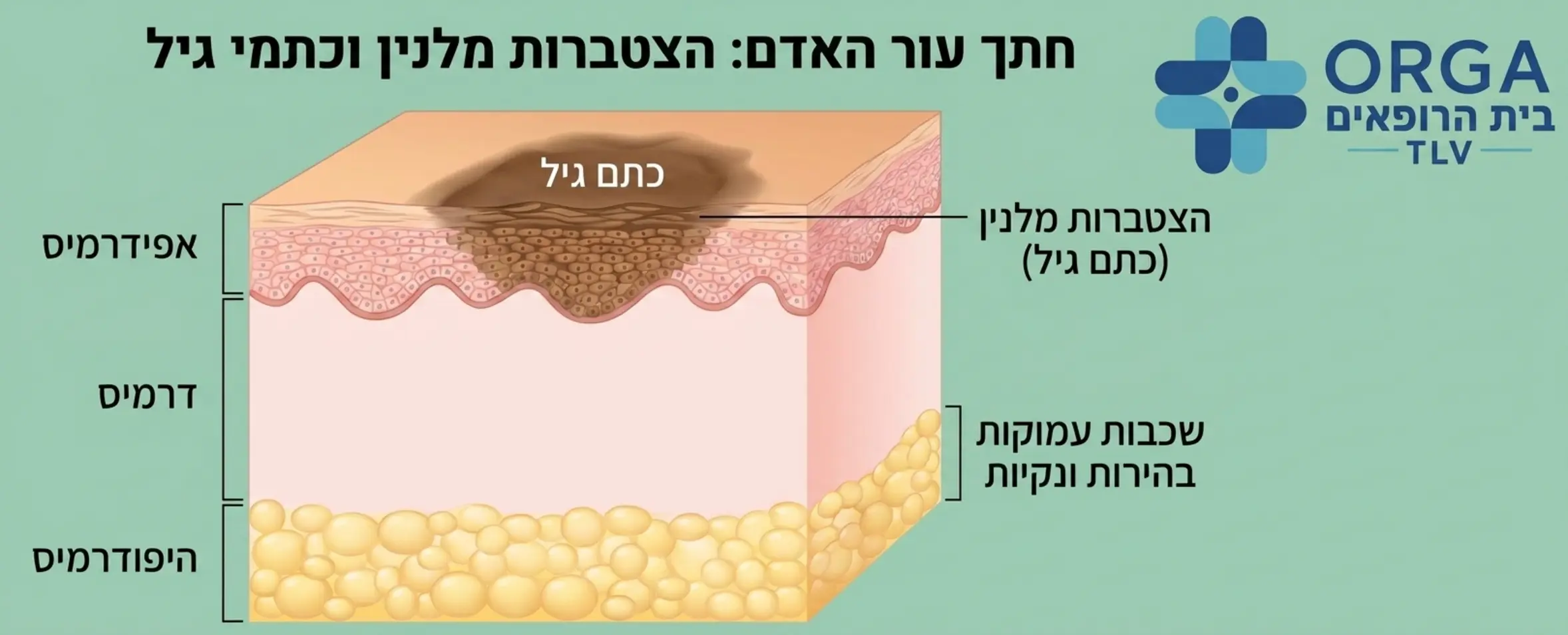 אינפוגרפיקה המדגימה את חתך עור האדם, המראה את שכבת האפידרמיס העליונה בה מצטבר המלנין היוצר את כתם הגיל, לעומת השכבות העמוקות יותר שנשארות נקיות ובהירות