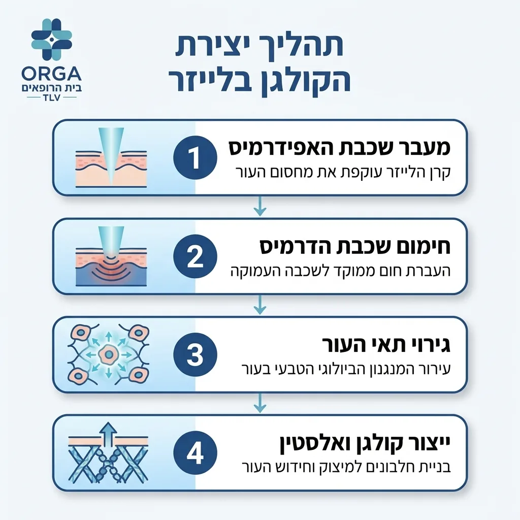 אינפוגרפיקה — תהליך יצירת הקולגן בלייזר: מעבר שכבת האפידרמיס, חימום שכבת הדרמיס, גירוי תאי העור, ייצור קולגן ואלסטין